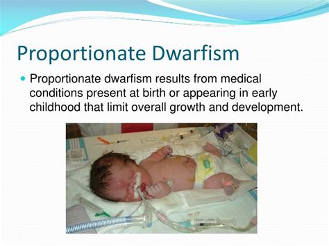 proportionate dwarfism pictures|signs of dwarfism in pregnancy.